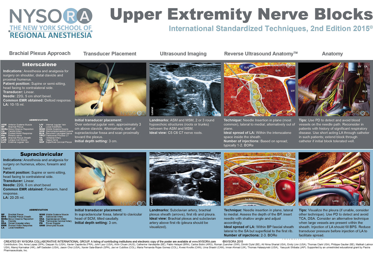 Interscalene and Supraclavicular