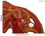 Accessory Phrenic Nerve