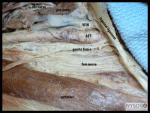 Essentials of Regional Anesthesia Anatomy