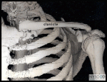 Supraclavicular Brachial Plexus Block