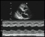 Ultrasound Physics