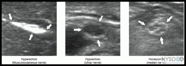 Ultrasound Physics