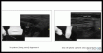 Optimizing an Ultrasound Image