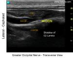 Greater Occipital Nerve