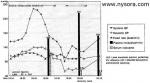 Hypertensive Crisis After A Successful Placement Of An Epidural Anesthetic In A Hypertensive Parturient