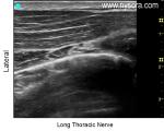 Long Thoracic Nerve