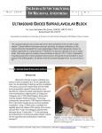 ULTRASOUND GUIDED SUPRACLAVICULAR BLOCK