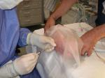 Spinal Anesthesia in Children