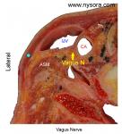 Vagus Nerve